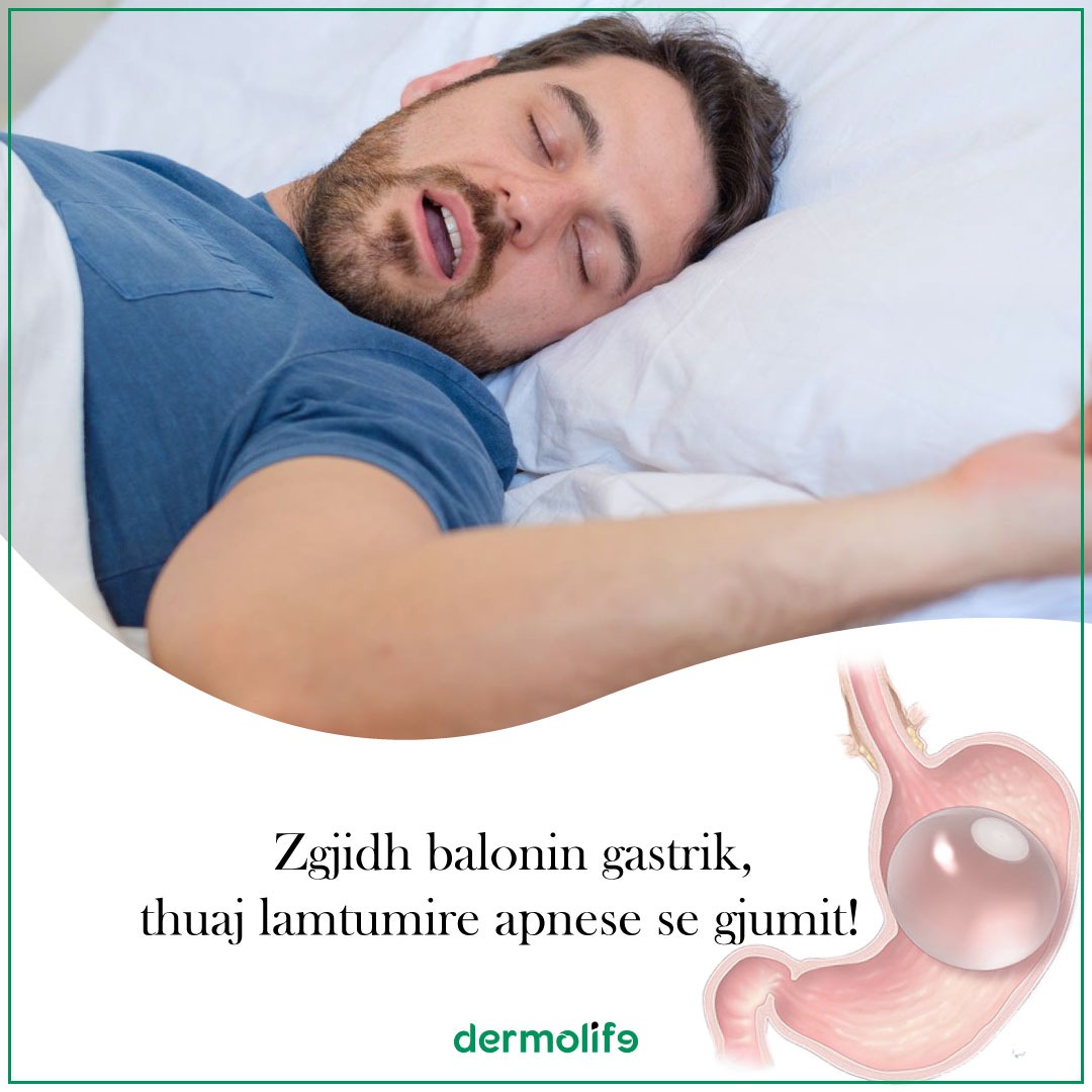 Deshmi Pacienti Baloni Gastrik